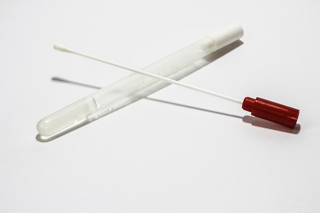 Coronavirus: in Valtellina si procede con i tamponi “drive-through”