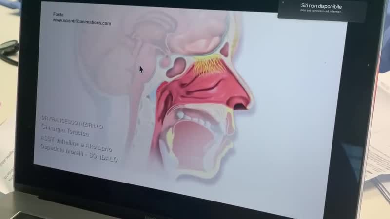 Coronavirus e influenza stagionale, sintomi e differenze spiegate da un medico del Morelli VIDEO