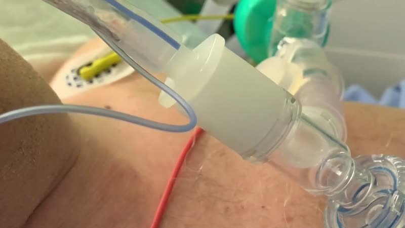 Tra i ricoverati nell’Ospedale Morelli, immagini e suoni dal fronte contro il coronavirus VIDEO