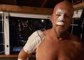 Investe un ciclista e scappa, si cercano testimoni