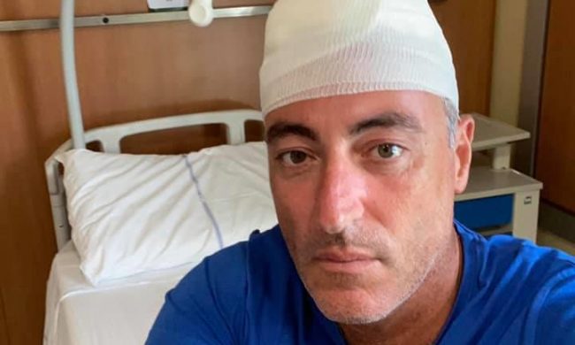 Infortunio mentre gioca a paddle, l’Assessore Gallera finisce in ospedale