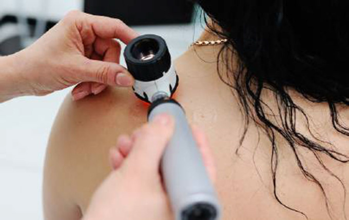 Nuovo servizio di Dermatologia presso la Clinica San Martino