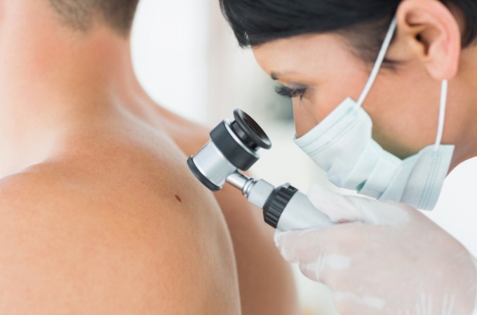 Pelle, visite di prevenzione all’Ambulatorio di Dermatologia