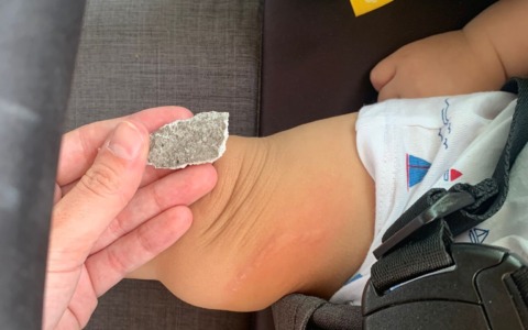 Bimbo di sette mesi colpito da un calcinaccio caduto da un palazzo